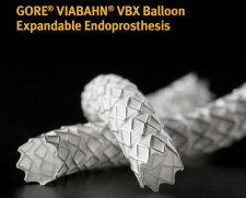 Gore Gore viabahn VBX | Used in Aortic stenting, Vascular stenting  | Which Medical Device